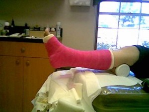 legcast1